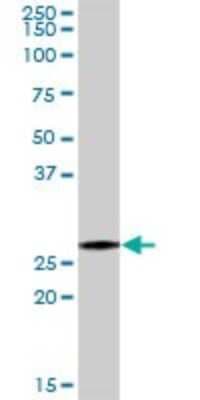 Western Blot: PSMA7 Antibody [H00005688-D01P]