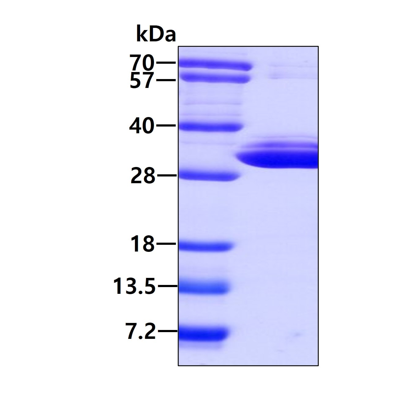 SDS-PAGE: Recombinant Human PSMA7 His Protein [NBC1-22917]