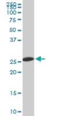 Western Blot: PSMA8 Antibody (2E3) [H00143471-M03]