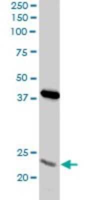 Western Blot: PSMA8 Antibody (2E3) [H00143471-M03]