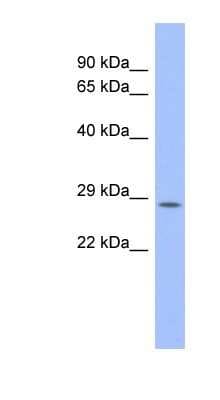 Western Blot: PSMB10/MECL1 Antibody [NBP1-58937]