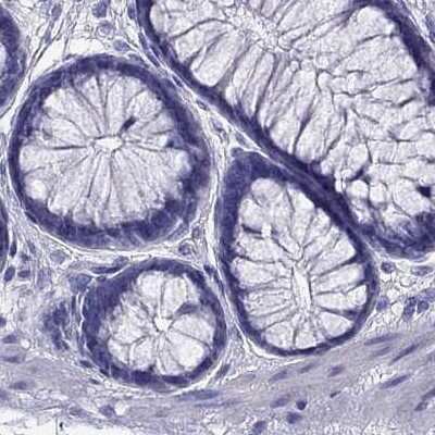 Immunohistochemistry-Paraffin: PSMB11 Antibody [NBP2-68605]