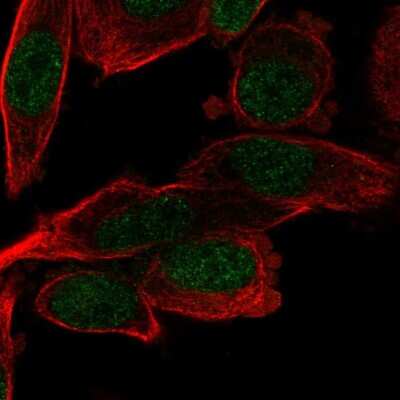 Immunocytochemistry/ Immunofluorescence: PSMB5 Antibody [NBP2-13820]