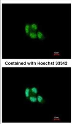 Immunocytochemistry/ Immunofluorescence: PSMB5 Antibody [NBP2-19983]