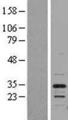 Western Blot: PSMB5 Overexpression Lysate [NBL1-14880]