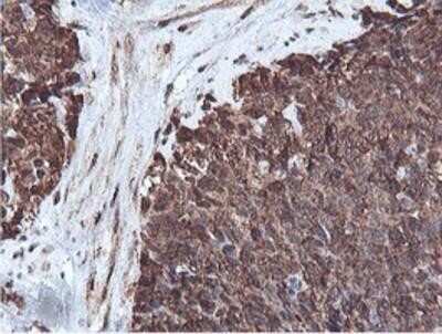 Immunohistochemistry: PSMB7 Antibody (OTI1E1) - Azide and BSA Free [NBP2-73645]