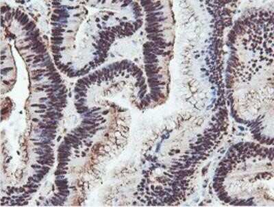 Immunohistochemistry: PSMB7 Antibody (OTI1E1) - Azide and BSA Free [NBP2-73645]