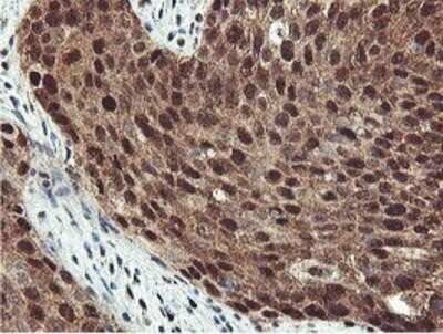 Immunohistochemistry: PSMB7 Antibody (OTI1E1) - Azide and BSA Free [NBP2-73645]