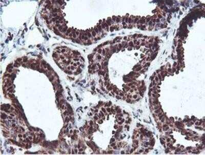 Immunohistochemistry: PSMB7 Antibody (OTI1E1) - Azide and BSA Free [NBP2-73645]