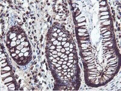 Immunohistochemistry: PSMB7 Antibody (OTI1E1) - Azide and BSA Free [NBP2-73645]