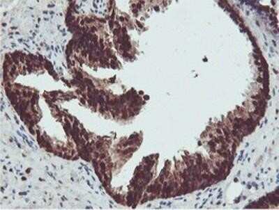 Immunohistochemistry: PSMB7 Antibody (OTI1E1) - Azide and BSA Free [NBP2-73645]