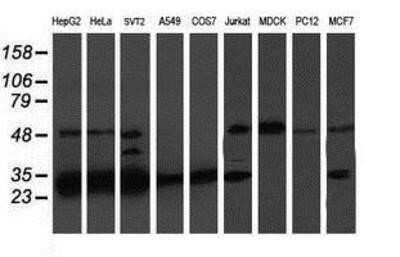 Western Blot: PSMB7 Antibody (OTI1E1)Azide and BSA Free [NBP2-73645]
