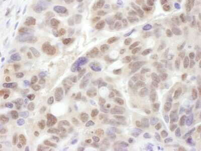 Immunohistochemistry-Paraffin: PSMC1 Antibody [NBP2-14857]