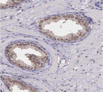 Immunohistochemistry-Paraffin: PSMC1 Antibody [NBP1-80959]