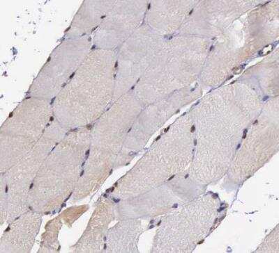 Immunohistochemistry-Paraffin: PSMC1 Antibody [NBP1-80959]