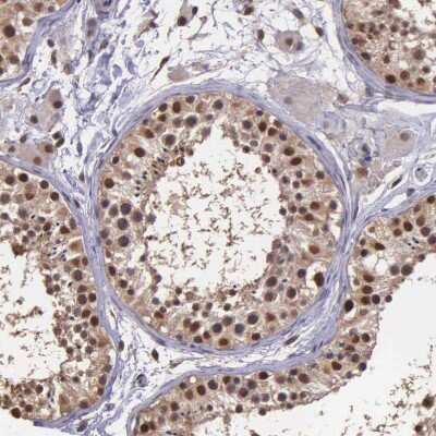 Immunohistochemistry-Paraffin: PSMC1 Antibody [NBP1-80959]