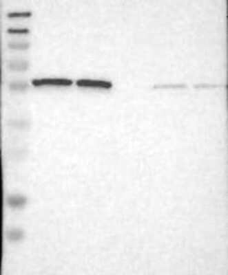 Western Blot: PSMC1 Antibody [NBP3-17916]