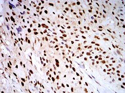 Immunohistochemistry-Paraffin: PSMC3 Antibody (1G10B7) - BSA Free [NBP2-61802]