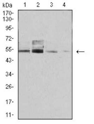 Western Blot: PSMC3 Antibody (1G10B7)BSA Free [NBP2-61802]