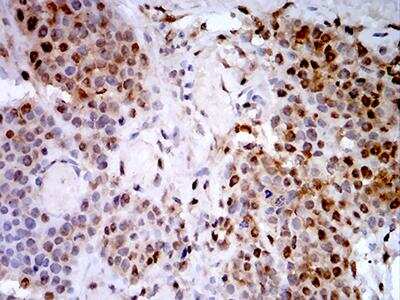 Immunohistochemistry-Paraffin: PSMC3 Antibody (1G10C9) - BSA Free [NBP2-61803]