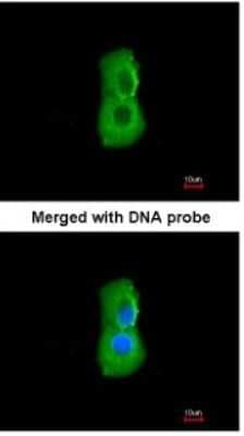 Immunocytochemistry/ Immunofluorescence: PSMC3 Antibody [NBP1-32749]