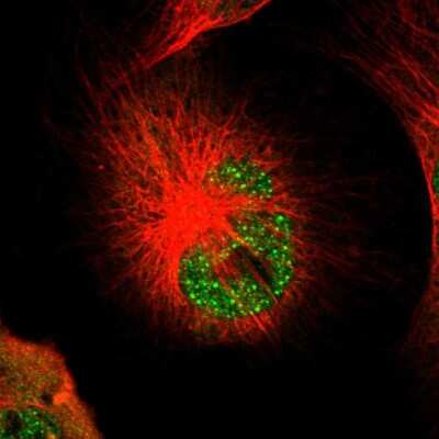 Immunocytochemistry/ Immunofluorescence: PSMC3 Antibody [NBP1-86962]