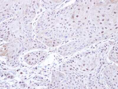 Immunohistochemistry-Paraffin: PSMC3 Antibody [NBP1-32749]