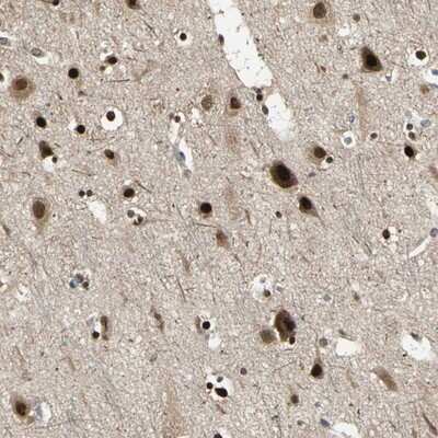 Immunohistochemistry-Paraffin: PSMC3 Antibody [NBP1-86962]
