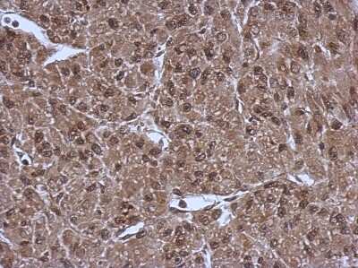 Immunohistochemistry-Paraffin: PSMC3 Antibody [NBP2-19984]