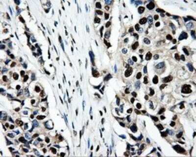 Immunohistochemistry: PSMC3 Antibody (OTI9F3) - Azide and BSA Free [NBP2-73696]