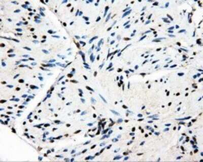 Immunohistochemistry: PSMC3 Antibody (OTI9F3) - Azide and BSA Free [NBP2-73696]