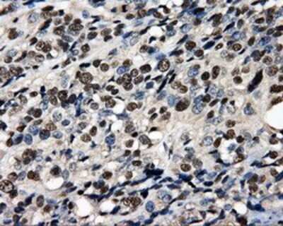Immunohistochemistry: PSMC3 Antibody (OTI9F3) - Azide and BSA Free [NBP2-73696]