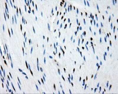 Immunohistochemistry: PSMC3 Antibody (OTI9F3) - Azide and BSA Free [NBP2-73696]