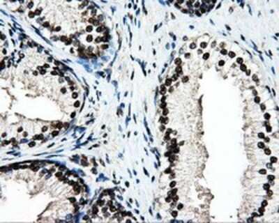 Immunohistochemistry: PSMC3 Antibody (OTI9F3) - Azide and BSA Free [NBP2-73696]