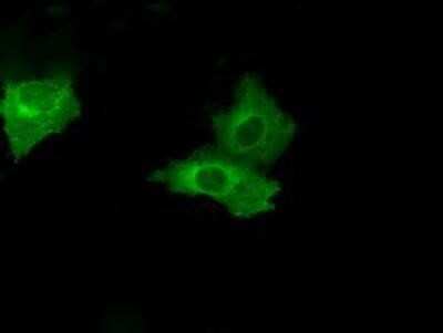 Immunocytochemistry/ Immunofluorescence: PSMC3 Antibody (OTI9F3) [NBP2-02316]
