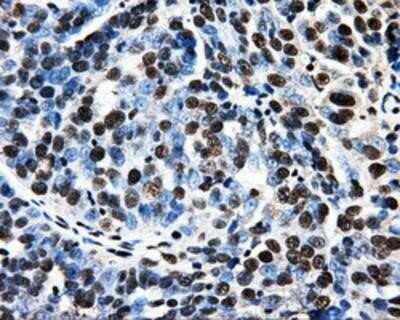 Immunohistochemistry-Paraffin: PSMC3 Antibody (OTI9F3) [NBP2-02316]