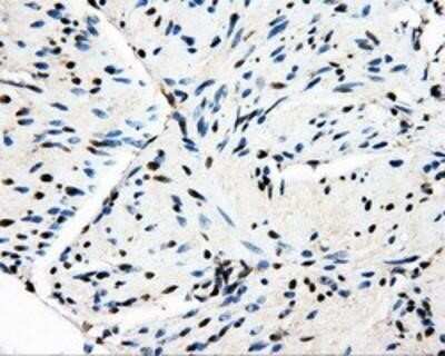 Immunohistochemistry-Paraffin: PSMC3 Antibody (OTI9F3) [NBP2-02316]