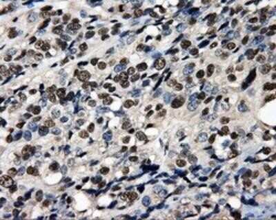Immunohistochemistry-Paraffin: PSMC3 Antibody (OTI9F3) [NBP2-02316]