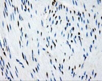 Immunohistochemistry-Paraffin: PSMC3 Antibody (OTI9F3) [NBP2-02316]