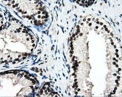 Immunohistochemistry-Paraffin: PSMC3 Antibody (OTI9F3) [NBP2-02316]