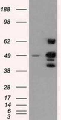 Western Blot: PSMC3 Antibody (OTI9F3) [NBP2-02316]