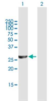 Western Blot: PSMC3IP Antibody [H00029893-B01P]