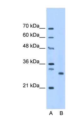 Western Blot: PSMC3IP Antibody [NBP1-79237]