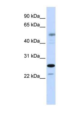 Western Blot: PSMC3IP Antibody [NBP1-79238]
