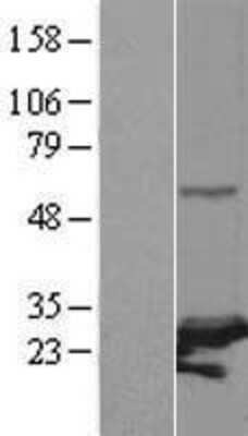 Western Blot: PSMC3IP Overexpression Lysate [NBL1-14889]