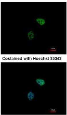 Immunocytochemistry/ Immunofluorescence: PSMC6 Antibody [NBP1-32403]