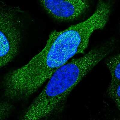 Immunocytochemistry/ Immunofluorescence: PSMC6 Antibody [NBP2-13822]