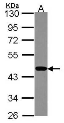 Western Blot: PSMC6 Antibody [NBP2-19985]