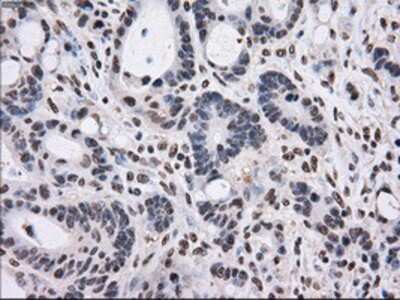 Immunohistochemistry-Paraffin: Gankyrin Antibody (OTI3F6) [NBP2-02199]