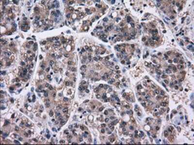 Immunohistochemistry-Paraffin: Gankyrin Antibody (OTI3F6) [NBP2-02199]